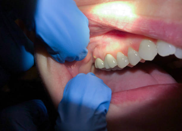 Best Tooth Pain Emergency Relief  in Terry, MS